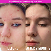 Load image into Gallery viewer, Niacinamide Serum