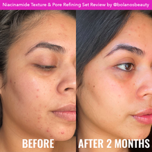 Load image into Gallery viewer, Niacinamide Texture &amp; Pore Refining Set